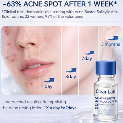 Clear Lab 1.8% Salicylic Acid Drying Lotion